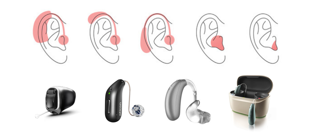 Solutions auditives variées chez audition-passion à Villeneuve-sur-Lot, modèles intra-auriculaires et contours d’oreille